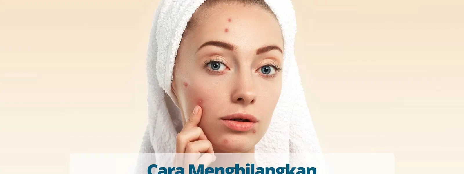 Cara Menghilangkan Jerawat