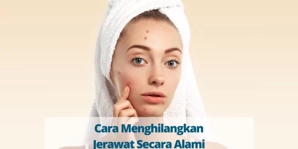 Cara Menghilangkan Jerawat